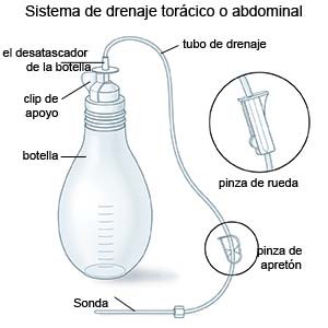 Sistema de drenaje abdominal o de pecho