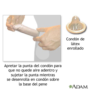 Apriete la punta del condón así no queda aire adentro y continúe agarrando la punta mientras lo desliza hacia la base del pene