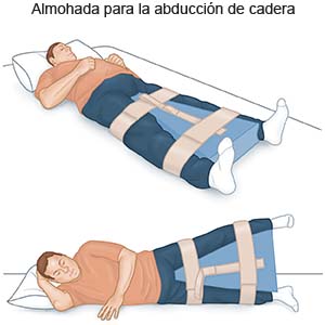 Almohada para la abducción de cadera