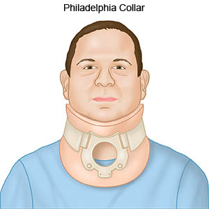 Philadelphia Collar