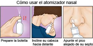 Cómo utilizar un spray nasal 