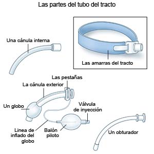 Partes del tubo de traqueostomía 