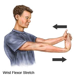 Wrist Flexor Stretch