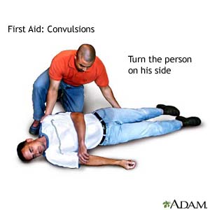 First Aid: Convulsions