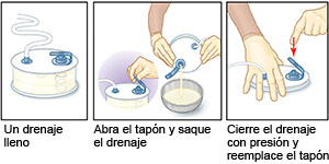 Tubo de drenaje Hemovac THA