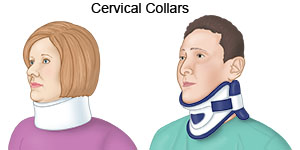 Cervical Collars