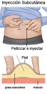 Inyección subcutánea