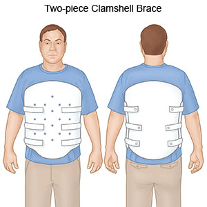 Clamshell brace for back store