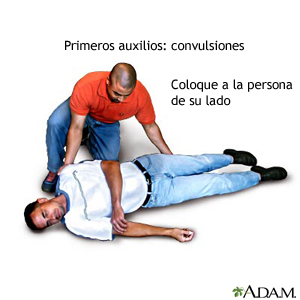 Primeros auxilios: Convulsiones