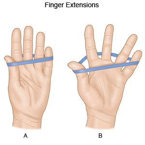 FINGER EXTENSIONS