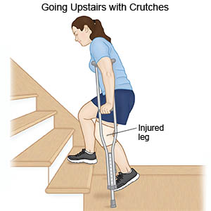 Crutches Going Upstairs With Crutches