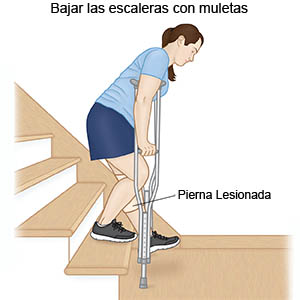 Bajar la escalera con muletas