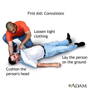 First Aid: Convulsions