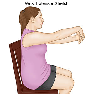 Wrist Extensor Stretch